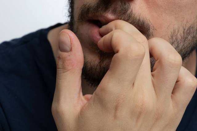 Hypnosis for Nail Biting | Stop Nail Biting Without Willpower | Wisconsin Hypnosis Center